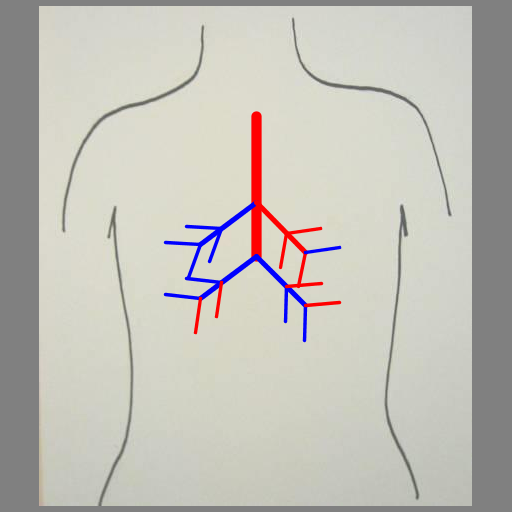 This program was inspired by the images of trees and branches we mentioned in class and that one student created in the fall of 2010 (shown on the assignment page). It creates lungs in the same way a tree might be created, by recursively drawing a line segment with branching points. The output is a series of blood vessicles, randomly colored blue or red, branching off from one another at a random angle within a specified range to give the appearance of lungs. The branching points occur at the end of the vessicle and along it (at the golden ratio).