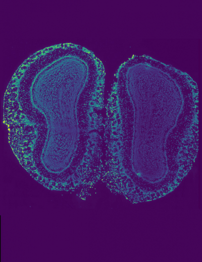 Tissue from mouse olfactory bulb