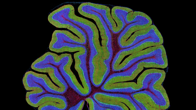Cerebellum in green and blue