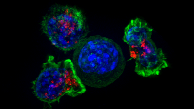 killer t cells surround a cancer cell