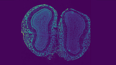 slice of tissue from a mouse olfactory bulb
