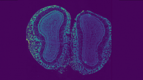 slice of tissue from a mouse olfactory bulb