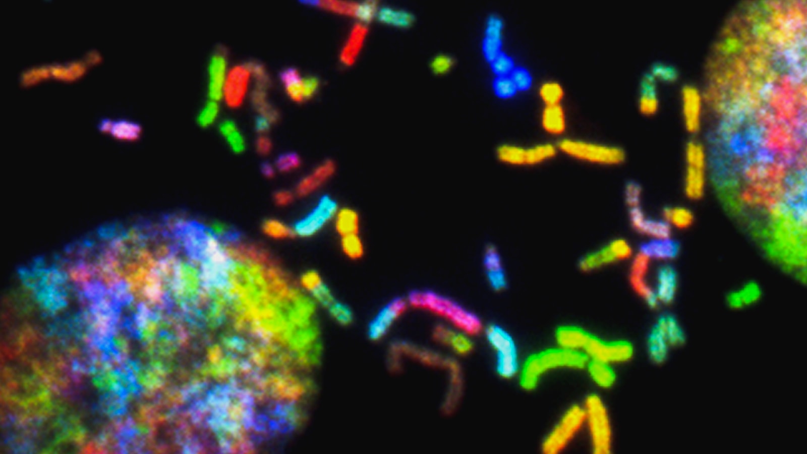 Colorful brain cancer chromosome image 